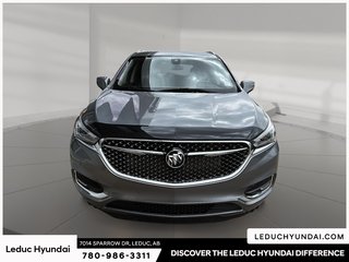 2020 Buick Enclave Avenir in Leduc, Alberta - 2 - w320h240px
