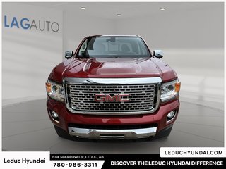 2018 GMC Canyon Denali in Leduc, Alberta - 2 - w320h240px