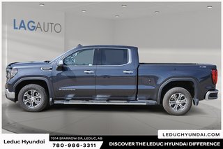 2024 GMC Sierra 1500 SLT in Leduc, Alberta - 5 - w320h240px