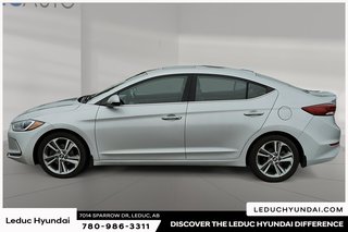 2017 Hyundai Elantra Limited Ultimate in Leduc, Alberta - 4 - w320h240px
