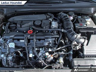 2025 Hyundai Elantra N-Line Ultimate in Leduc, Alberta - 6 - w320h240px