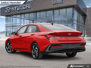 2026 Hyundai Elantra Preferred with Tech Pkg in Leduc, Alberta - 4 - w320h240px