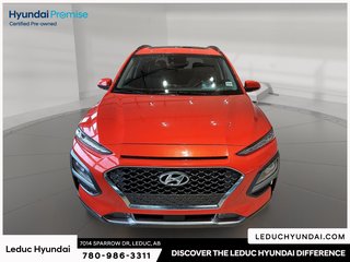 2020 Hyundai Kona 1.6T Ultimate in Leduc, Alberta - 2 - w320h240px