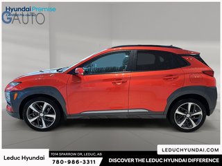 2020 Hyundai Kona 1.6T Ultimate in Leduc, Alberta - 5 - w320h240px