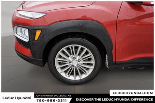 2021 Hyundai Kona 2.0L Preferred in Leduc, Alberta - 4 - w320h240px