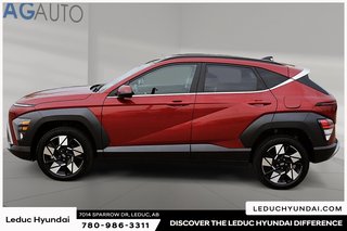 2024 Hyundai Kona 2.0L Preferred in Leduc, Alberta - 5 - w320h240px