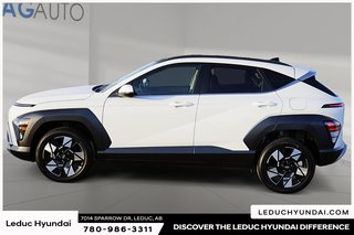 2025 Hyundai Kona 2.0L Preferred in Leduc, Alberta - 5 - w320h240px