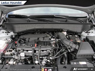 2026 Hyundai Kona N Line Ultimate w/ Two-tone in Leduc, Alberta - 6 - w320h240px
