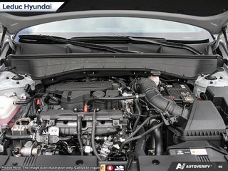 2026 Hyundai Kona N Line w/ Two-Tone in Leduc, Alberta - 6 - w320h240px