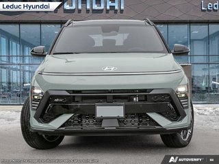 2026 Hyundai Kona N Line Ultimate w/ Two-tone in Leduc, Alberta - 2 - w320h240px