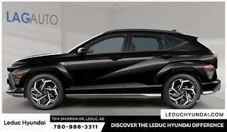 2027 Hyundai Kona Luxury in Leduc, Alberta - 2 - w320h240px