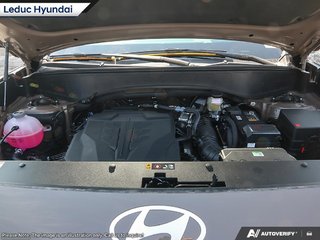 2026 Hyundai Palisade Ultimate Calligraphy in Leduc, Alberta - 6 - w320h240px