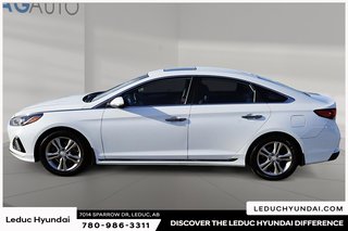 2018 Hyundai Sonata Sport in Leduc, Alberta - 5 - w320h240px