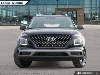 2025 Hyundai Venue Ultimate - Black interior in Leduc, Alberta - 2 - w320h240px