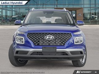2025 Hyundai Venue Ultimate - Black interior in Leduc, Alberta - 2 - w320h240px