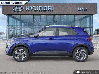 2025 Hyundai Venue Ultimate - Black interior in Leduc, Alberta - 3 - w320h240px