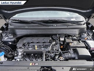 2026 Hyundai Venue Ultimate - Black interior in Leduc, Alberta - 6 - w320h240px
