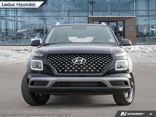 2026 Hyundai Venue Ultimate - Black interior in Leduc, Alberta - 2 - w320h240px