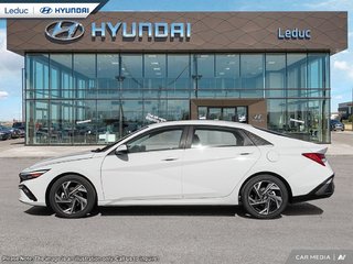 2025  Elantra Hybrid LUXURY in Leduc, Alberta - 3 - w320h240px