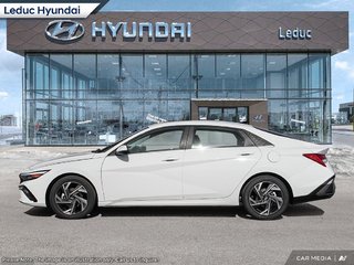 2025 Hyundai Elantra Hybrid LUXURY in Leduc, Alberta - 3 - w320h240px