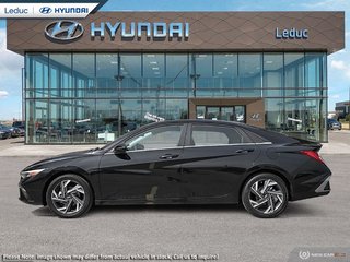 2025  Elantra LUXURY in Leduc, Alberta - 3 - w320h240px