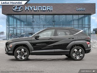 2025 Hyundai Kona PREFERRED TREND in Leduc, Alberta - 3 - w320h240px