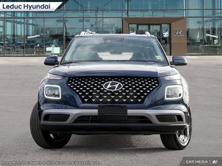 2025 Hyundai Venue Ultimate in Leduc, Alberta - 2 - w320h240px
