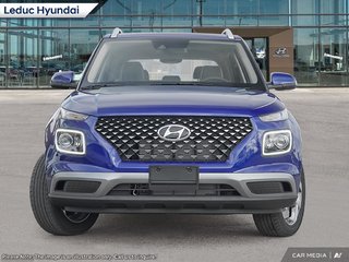 2025 Hyundai Venue Ultimate in Leduc, Alberta - 2 - w320h240px