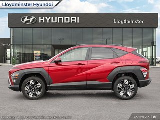 2025 Hyundai Kona Preferred in Lloydminster, Saskatchewan - 3 - w320h240px