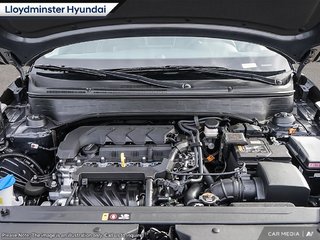 2025 Hyundai Venue Ultimate in Lloydminster, Saskatchewan - 6 - w320h240px