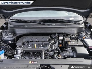 2026 Hyundai Venue Ultimate in Lloydminster, Saskatchewan - 6 - w320h240px