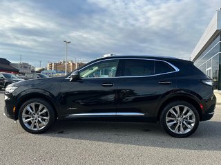 2022 Buick ENVISION in Pickering, Ontario - 3 - w320h240px