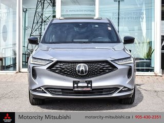 2022  MDX Black Friday.. Zero Down $167 weekly All In!!! in Whitby, Ontario - 3 - w320h240px