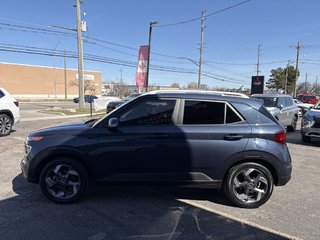 2023 Hyundai Venue ULTIMATE   DENIM INTERIOR   SUNROOF   CARPLAY in Oakville, Ontario - 5 - w320h240px