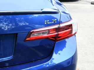 2017 Acura ILX A-Spec