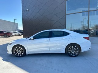 2016 Acura TLX V6 Elite in Winnipeg, Manitoba - 2 - px