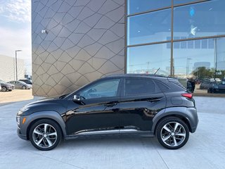 2018 Hyundai Kona Ultimate in Winnipeg, Manitoba - 3 - px