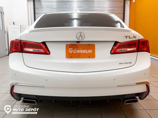 Acura TLX  2018 à St-Jérôme, Québec - 8 - w320h240px