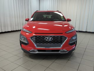 2018 Hyundai Kona Ultimate in Dartmouth, Nova Scotia - 3 - w320h240px