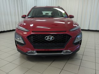 2020 Hyundai Kona Preferred in Dartmouth, Nova Scotia - 3 - w320h240px