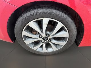 2017 Hyundai Accent (5) SE in Stratford, Ontario - 6 - w320h240px
