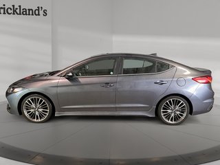 2018  Elantra GT Sport MT in Stratford, Ontario - 5 - w320h240px