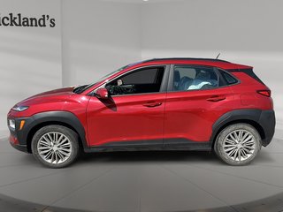 2020 Hyundai Kona 1.6T AWD Trend in Stratford, Ontario - 5 - w320h240px