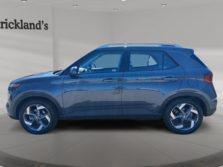 2023 Hyundai Venue FWD Ultimate w/ Black Interior in Stratford, Ontario - 5 - w320h240px