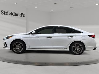 2018 Hyundai Sonata 2.0T Sport in Brantford, Ontario - 5 - w320h240px