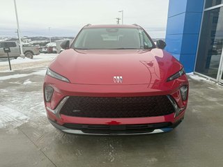 2026 Buick Envision Sport Touring in Grand Falls, New Brunswick - 3 - w320h240px