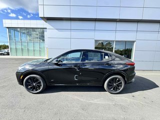 2025 Buick Envista SPORT TOURING in Tracadie-Sheila, New Brunswick - 3 - w320h240px