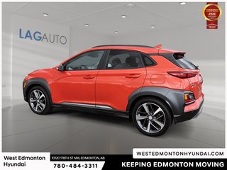 2020 Hyundai Kona 1.6T Ultimate in Edmonton, Alberta - 5 - w320h240px
