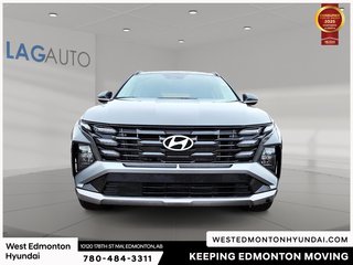 2025 Hyundai Tucson Preferred in Edmonton, Alberta - 3 - w320h240px
