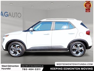 2022 Hyundai Venue Ultimate in Edmonton, Alberta - 5 - w320h240px